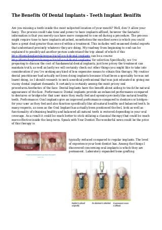 The Benefits Of Dental Implants - Teeth Implant Benifits
Are you missing a tooth inside the most subjected location of your mouth? Well, don 't allow your
fancy. The process could take time and power to have implants affixed, however the fantastic
information is that you merely can have more compared to one ed during a procedure. The process
might require time to have implants attached, nonetheless the excellent news is which you could
have a great deal greater than one ed within a treatment. This includes well-seasoned dental experts
that understand precisely whatever they are doing. My roadway from beginning to end can be
explained to possibly aid another person understand the trip ahead of which if this
http://dentalimplantslasvegas.biz/all-on-4-dental-implants can be a course
http://dentalimplantslasvegas.biz/all-on-4-dental-implants/ for selection.Specifically, we 're
preparing to discuss the cost of fundamental dental implants, just how pricey the treatment can
maintain truth, as well as lastly we will certainly check out other things you might like to take into
consideration if you 're seeking any kind of less expensive means to obtain this therapy. My routine
dental practitioner had actually not been doing implants because it had been a speciality he was not
learnt doing, so I should research to seek a medical professional that was just educated in giving me
via my dental implant demands. It certainly is certainly among the most pricey oral
procedures.Aesthetics of the face: Dental Implants have the benefit about aiding to track the natural
appearance of the face. Performance: Dental implants provide an enhanced performance-compared
to dentures or bridges-for that user since they really feel and operate precisely like natural healthy
teeth. Performance: Oral implants give an improved performance-compared to dentures or bridges-
for your user as they feel and also function specifically like all-natural healthy and balanced teeth. In
many respects, as soon as the Oral Implant has actually been positioned the feel, look as well as
functionality of obtaining healthy and balanced all-natural teeth is restored.depending in your oral
coverage. As a result it could be much better to stick utilizing a classical therapy that could be much
more effective inside the long term. Speak with Your Dentist.The wonderful news could be the price
of this therapy is
typically reduced compared to regular implants. The level
of experience your best dentist has. Among the things I
discovered concerning oral implants is which they are
permanent. Laboratory expanded bone grafting
 