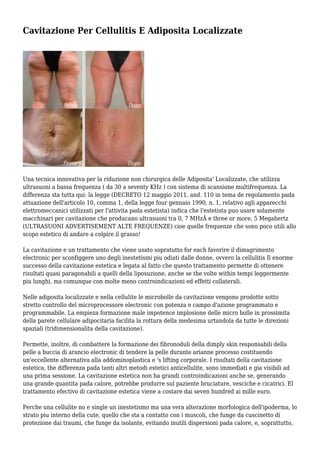 Macchina Per La Bellezza Cavitazione Ultrasuoni 6 In 1, 80K RF Macchina - Foto 6