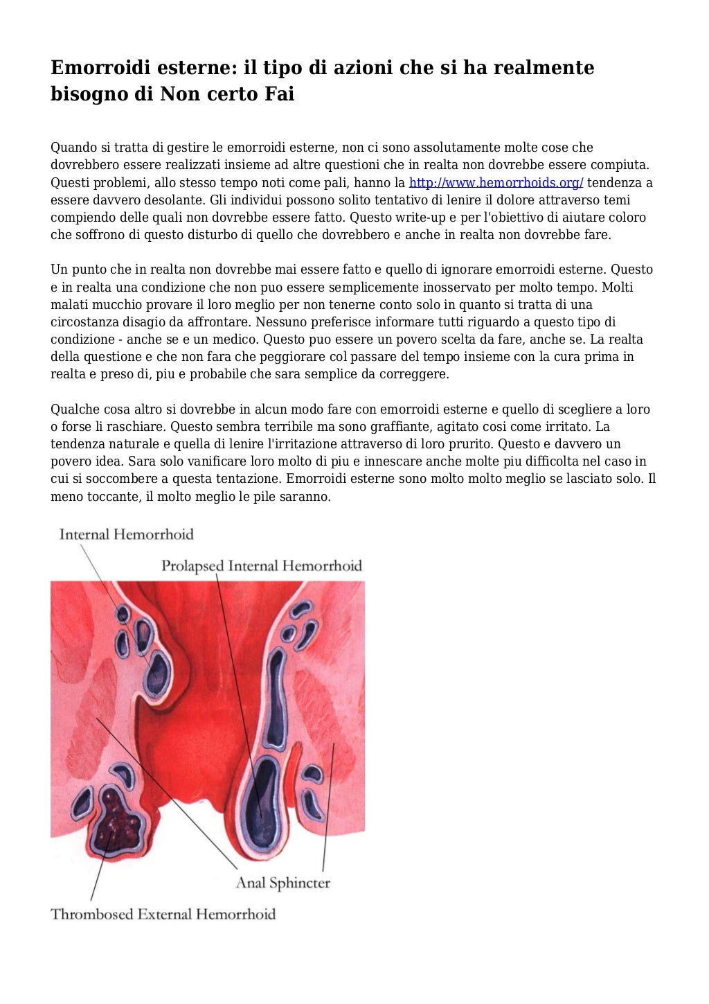 Emorroidi esterne il tipo di azioni che si ha realmente bisogno di N…