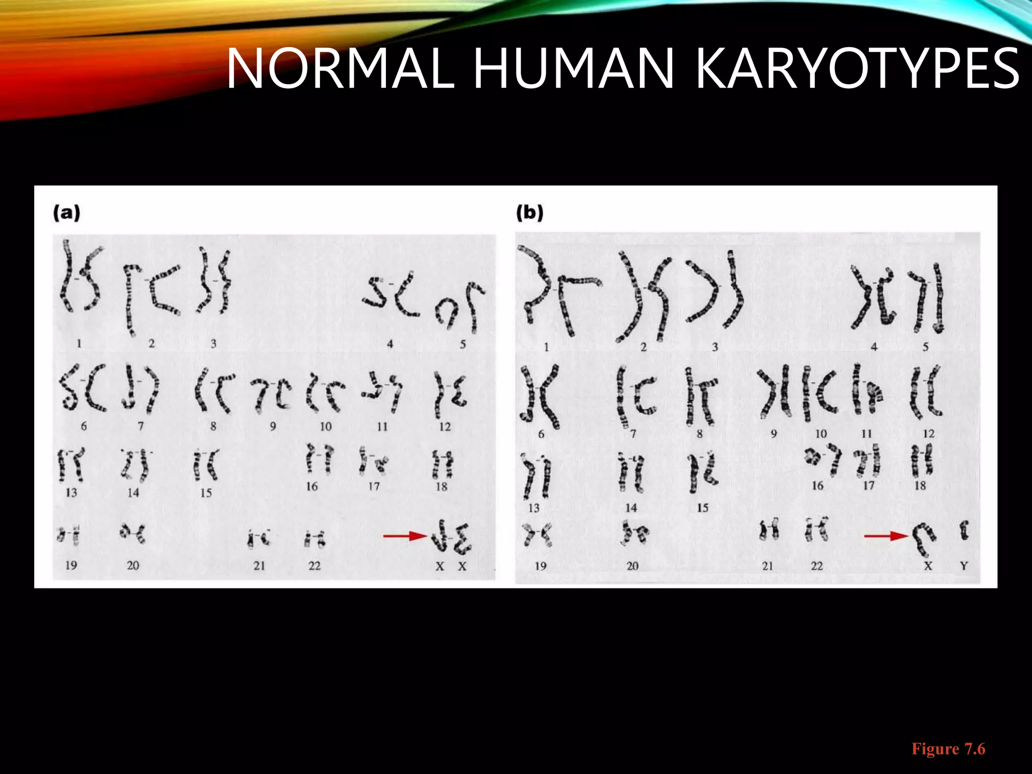 Figure 7.6
NORMAL HUMAN KARYOTYPES
 