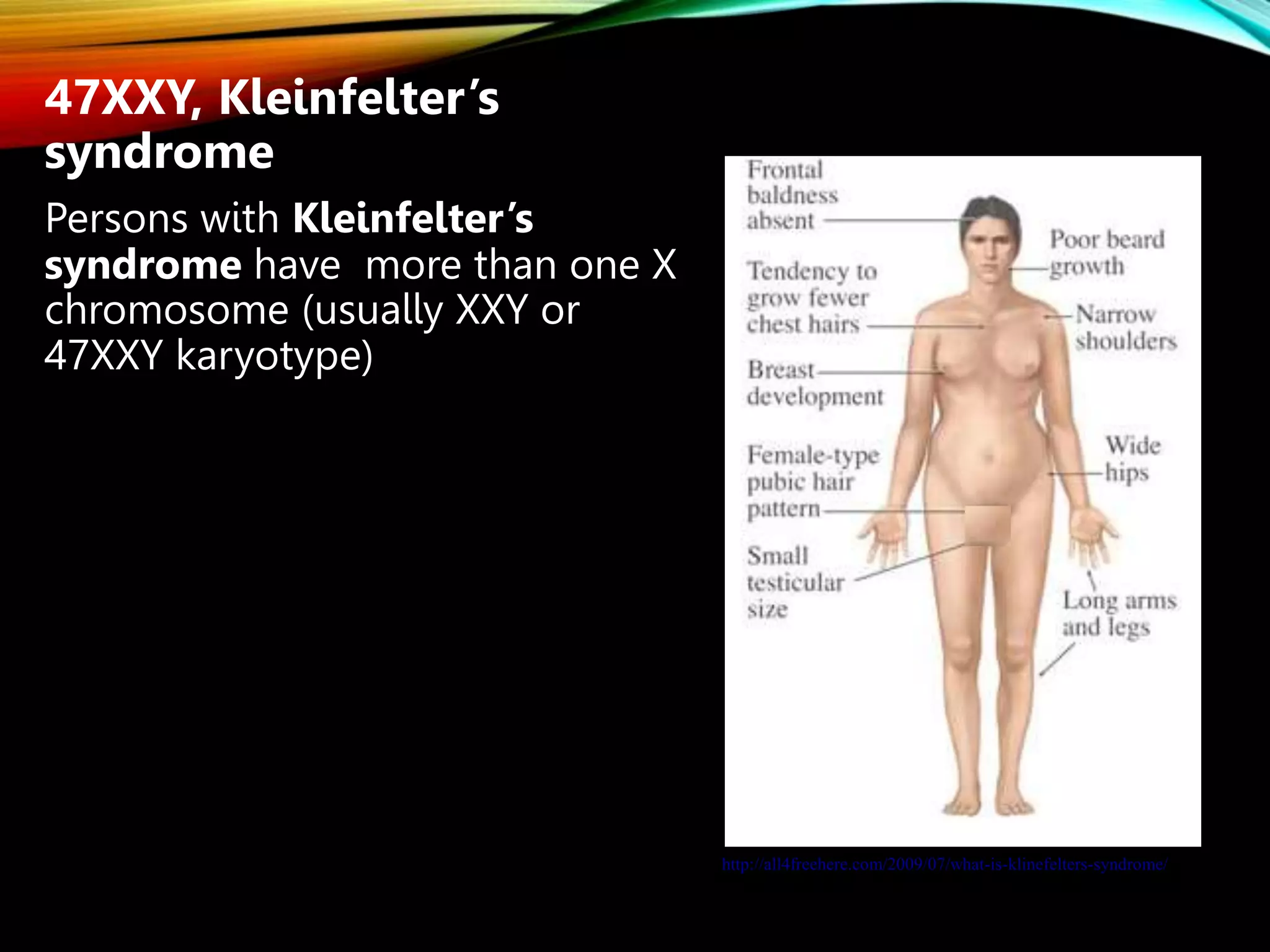 47XXY, Kleinfelter’s
syndrome
Persons with Kleinfelter’s
syndrome have more than one X
chromosome (usually XXY or
47XXY karyotype)
http://all4freehere.com/2009/07/what-is-klinefelters-syndrome/
 