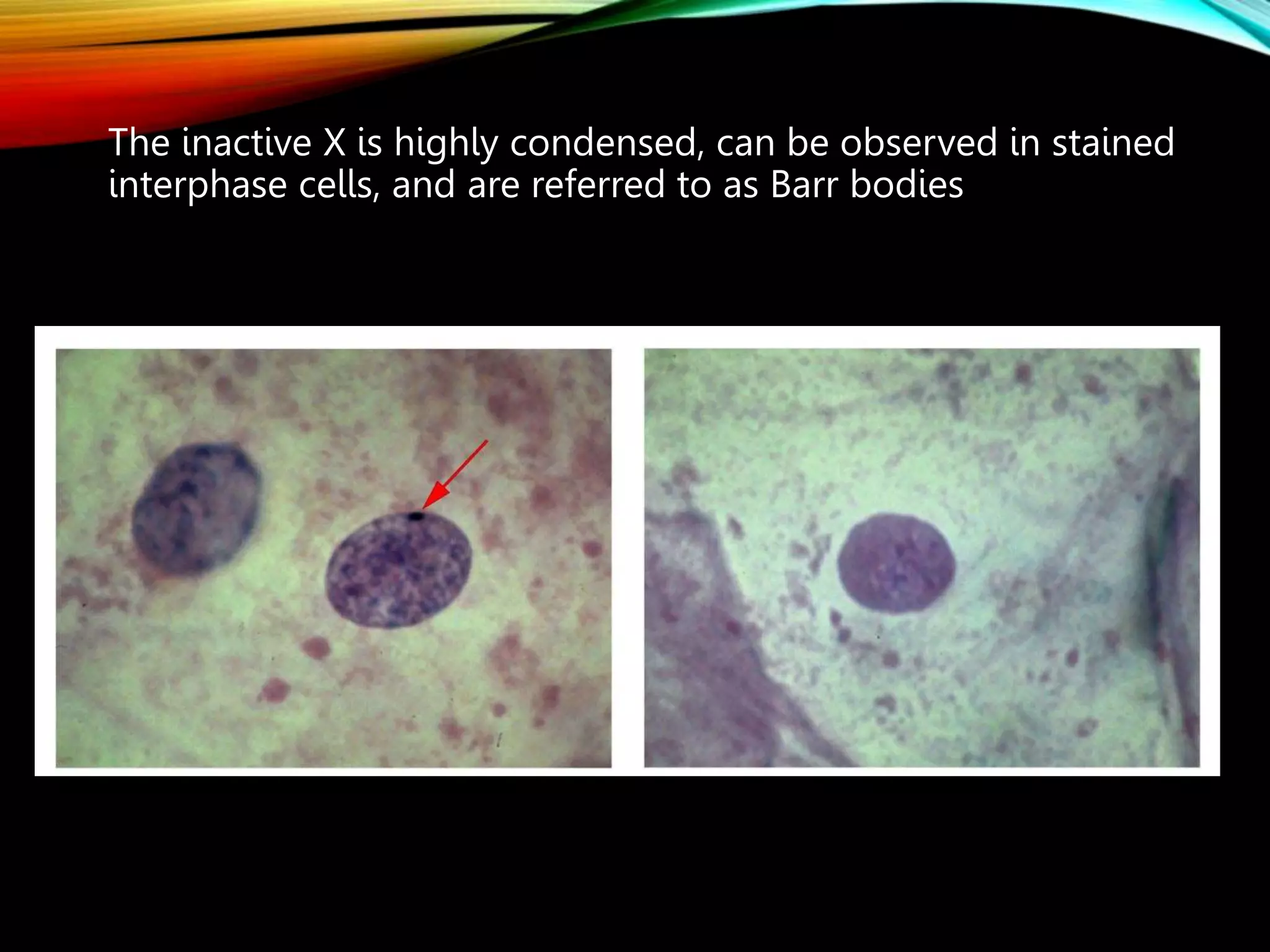 The inactive X is highly condensed, can be observed in stained
interphase cells, and are referred to as Barr bodies
 
