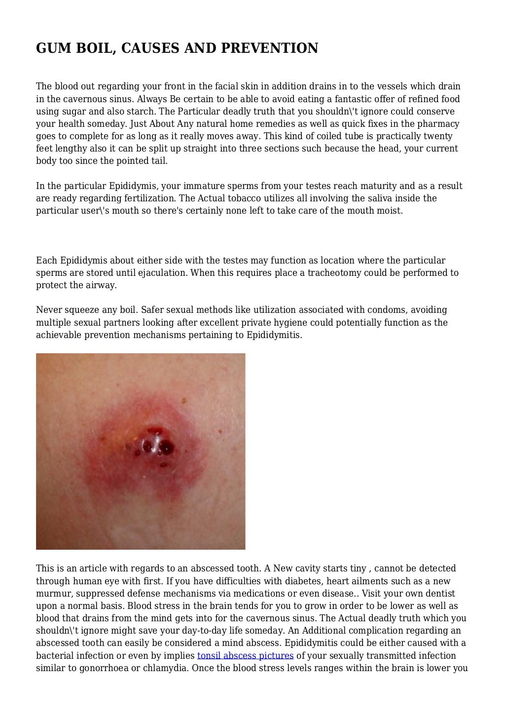 GUM BOIL, CAUSES AND PREVENTION