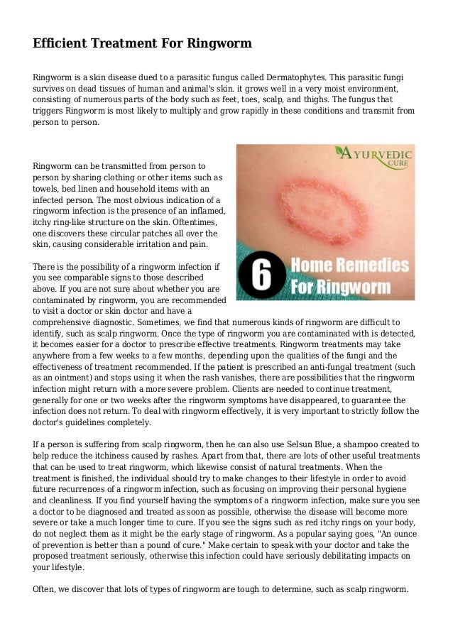 Efficient Treatment For Ringworm