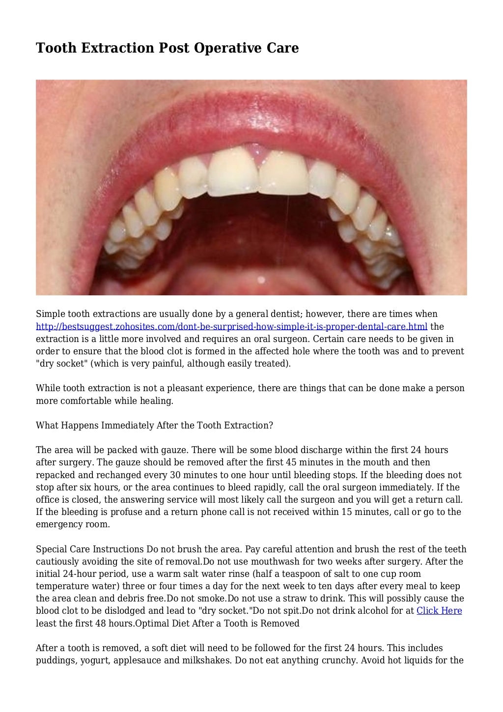 Tooth Extraction Post Operative Care