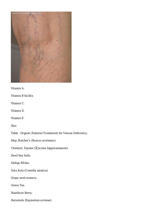 varicose veins vitamin deficiency varicose veins vitamin deficiency
