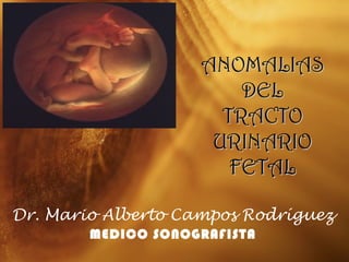 Dr. Mario Alberto Campos Rodríguez
MEDICO SONOGRAFISTA
ANOMALIASANOMALIAS
DELDEL
TRACTOTRACTO
URINARIOURINARIO
FETALFETAL
 
