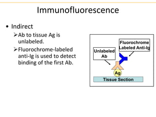 Immunofluorescence
• Indirect
Ab to tissue Ag is
unlabeled.
Fluorochrome-labeled
anti-Ig is used to detect
binding of the first Ab.
Ag
Fluorochrome
Labeled Anti-Ig
Tissue Section
Unlabeled
Ab
 