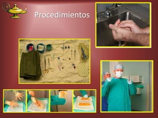 Procedimientos
 