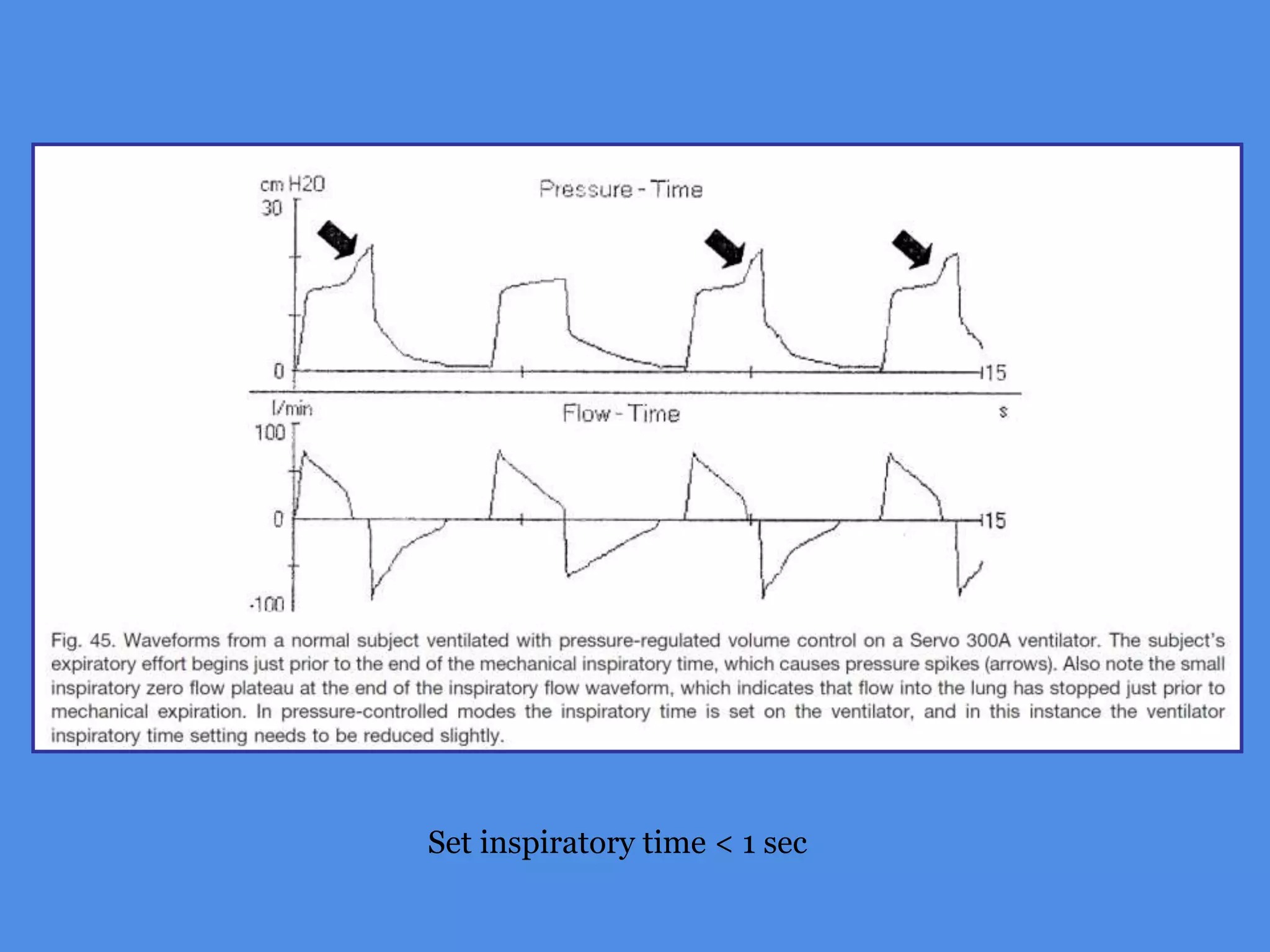 Set inspiratory time < 1 sec
 