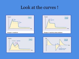 Look at the curves !
 