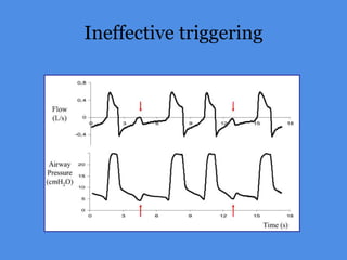 Ineffective triggering
 