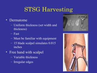 STSG Harvesting Dermatome Uniform thickness (set width and thickness) Fast Must be familiar with equipment 15 blade scalpel simulates 0.015 inches Free hand with scalpel Variable thickness Irregular edges 