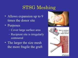 STSG Meshing Allows expansion up to 9 times the donor site Purposes Cover large surface area Recipient site is irregularly contoured The larger the size mesh the more fragile the graft 