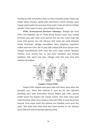 berulang atau ISK menyebabkan observasi bukan merupakan pilihan. Begitu juga
dengan adanya obstruksi, apalagi pada pasien-pasien tertentu (misalnya ginjal
tunggal, ginjal trasplan dan penurunan fungsi ginjal ) tidak ada toleransi terhadap
obstruksi. Pasien seperti ini harus segera dilakukan intervensi.
ESWL (Extracorporeal Shockwave Lithotripsy). Berbagai tipe mesin
ESWL bisa didapatkan saat ini. Walau prinsip kerjanya semua sama, terdapat
perbedaan yang nyata antara mesin generasi lama dan baru, dalam terapi batu
ureter. Pada generasi baru titik fokusnya lebih sempit dan sudah dilengkapi
dengan flouroskopi, sehingga memudahkan dalam pengaturan target/posisi
tembak untuk batu ureter. Hal ini yang tidak terdapat pada mesin generasi lama,
sehingga pemanfaatannya untuk terapi batu ureter sangat terbatas. Meskipun
demikian mesin generasi baru ini juga punya kelemahan yaitu kekuatan
tembaknya tidak sekuat yang lama, sehingga untuk batu yang keras perlu
beberapa kali tindakan.
Gambar 3. Proses ESWL
Dengan ESWL sebagian besar pasien tidak perlu dibius, hanya diberi obat
penangkal nyeri. Pasien akan berbaring di suatu alat dan akan dikenakan
gelombang kejut untuk memecahkan batunya Bahkan pada ESWL generasi
terakhir pasien bisa dioperasi dari ruangan terpisah. Jadi, begitu lokasi ginjal
sudah ditemukan, dokter hanya menekan tombol dan ESWL di ruang operasi akan
bergerak. Posisi pasien sendiri bisa telentang atau telungkup sesuai posisi batu
ginjal. Batu ginjal yang sudah pecah akan keluar bersama air seni. Biasanya
pasien tidak perlu dirawat dan dapat langsung pulang.
18
 