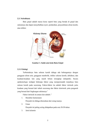 2.3. Nefrolitiasis
Batu ginjal adalah massa keras seperti batu yang berada di ginjal dan
salurannya dan dapat menyebabkan nyeri, perdarahan, penyumbatan aliran kemih,
atau infeksi.
Gambar 1. Salah satu letak Batu Ginjal
2.3.1 Etiologi
Terbentuknya batu saluran kemih diduga ada hubungannya dengan
gangguan aliran urin, gangguan metabolik, infeksi saluran kemih, dehidrasi, dan
keadaan-keadaan lain yang masih belum terungkap (idiopatik). Secara
epidemiologis terdapat beberapa faktor yang mempermudah terjadinya batu
saluran kemih pada seseorang. Faktor-faktor itu adalah faktor intrinsik yaitu
keadaan yang berasal dari tubuh seseorang dan faktor ekstrinsik yaitu pengaruh
yang berasal dari lingkungan sekitarnya.5
Faktor intrinsik itu antara lain adalah :5
1. Herediter (keturunan)
Penyakit ini diduga diturunkan dari orang tuanya.
2. Umur
Penyakit ini paling sering didapatkan pada usia 30-50 tahun.
3. Jenis kelamin
5
 