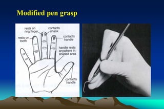 Modified pen grasp
 