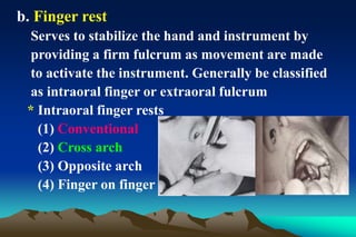 b. Finger rest
Serves to stabilize the hand and instrument by
providing a firm fulcrum as movement are made
to activate the instrument. Generally be classified
as intraoral finger or extraoral fulcrum
* Intraoral finger rests
(1) Conventional
(2) Cross arch
(3) Opposite arch
(4) Finger on finger
 