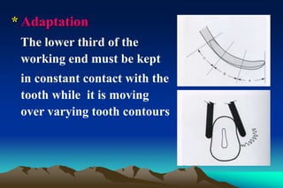 * Adaptation
The lower third of the
working end must be kept
in constant contact with the
tooth while it is moving
over varying tooth contours
 