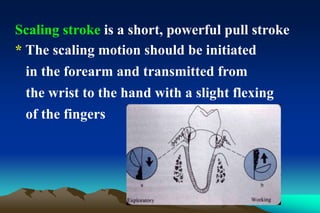 Scaling stroke is a short, powerful pull stroke
* The scaling motion should be initiated
in the forearm and transmitted from
the wrist to the hand with a slight flexing
of the fingers
 