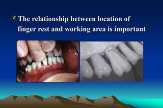 * The relationship between location of
finger rest and working area is important
 