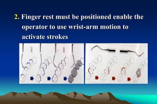 2. Finger rest must be positioned enable the
operator to use wrist-arm motion to
activate strokes
 