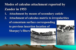 Modes of calculus attachment reported by
Zander in 1953
1. Attachment by means of secondary cuticle
2. Attachment of calculus matrix to irregularities
of cementum surface corresponding
to previous insertion location of
Sharpey’s fibers
 