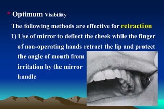 * Optimum Visibility
The following methods are effective for retraction
1) Use of mirror to deflect the cheek while the finger
of non-operating hands retract the lip and protect
the angle of mouth from
irritation by the mirror
handle
 