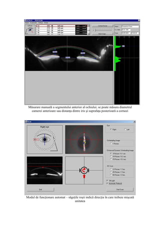 Măsurare manuală a segmentului anterior al ochiului; se poate măsura diametrul
camerei anterioare sau distanţa dintre iris şi suprafaţa posterioară a corneei
Modul de funcţionare automat – săgeţile roşii indică direcţia în care trebuie mişcată
unitatea
 