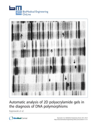 Automatic analysis of 2D polyacrylamide gels in
the diagnosis of DNA polymorphisms
Koprowski et al.
Koprowski et al. BioMedical Engineering OnLine 2013, 11:71
http://www.biomedical-engineering-online.com/content/11/1/71

 