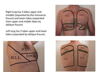 Right lung has 3 lobes upper and
meddle (separated by the transverse
fissure) and lower lobes (separated
from upper and middle lobes by
oblique fissure)
Left lung has 2 lobes upper and lower
lobes (separated by oblique fissure).
 