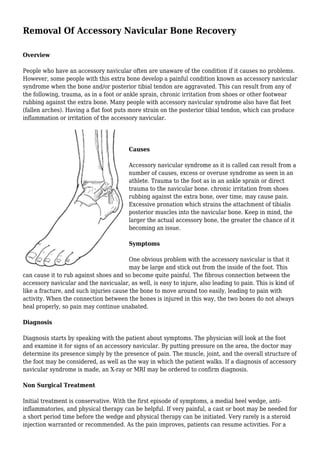 Removal Of Accessory Navicular Bone Recovery
Overview
People who have an accessory navicular often are unaware of the condition if it causes no problems.
However, some people with this extra bone develop a painful condition known as accessory navicular
syndrome when the bone and/or posterior tibial tendon are aggravated. This can result from any of
the following, trauma, as in a foot or ankle sprain, chronic irritation from shoes or other footwear
rubbing against the extra bone. Many people with accessory navicular syndrome also have flat feet
(fallen arches). Having a flat foot puts more strain on the posterior tibial tendon, which can produce
inflammation or irritation of the accessory navicular.
Causes
Accessory navicular syndrome as it is called can result from a
number of causes, excess or overuse syndrome as seen in an
athlete. Trauma to the foot as in an ankle sprain or direct
trauma to the navicular bone. chronic irritation from shoes
rubbing against the extra bone, over time, may cause pain.
Excessive pronation which strains the attachment of tibialis
posterior muscles into the navicular bone. Keep in mind, the
larger the actual accessory bone, the greater the chance of it
becoming an issue.
Symptoms
One obvious problem with the accessory navicular is that it
may be large and stick out from the inside of the foot. This
can cause it to rub against shoes and so become quite painful. The fibrous connection between the
accessory navicular and the navicualar, as well, is easy to injure, also leading to pain. This is kind of
like a fracture, and such injuries cause the bone to move around too easily, leading to pain with
activity. When the connection between the bones is injured in this way, the two bones do not always
heal properly, so pain may continue unabated.
Diagnosis
Diagnosis starts by speaking with the patient about symptoms. The physician will look at the foot
and examine it for signs of an accessory navicular. By putting pressure on the area, the doctor may
determine its presence simply by the presence of pain. The muscle, joint, and the overall structure of
the foot may be considered, as well as the way in which the patient walks. If a diagnosis of accessory
navicular syndrome is made, an X-ray or MRI may be ordered to confirm diagnosis.
Non Surgical Treatment
Initial treatment is conservative. With the first episode of symptoms, a medial heel wedge, anti-
inflammatories, and physical therapy can be helpful. If very painful, a cast or boot may be needed for
a short period time before the wedge and physical therapy can be initiated. Very rarely is a steroid
injection warranted or recommended. As the pain improves, patients can resume activities. For a
 