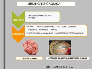 MENINGITIS CRÓNICA
CEREBRO SANO CEREBRO CON MENINGITIS TUBERCULOSA
ETIOLOGÍA
• MYCOBACTERIUM tuberculosis.
• HONGOS.
PATOGENIA
•VÍA AÉREA →TORRENTE SANGUÍNEO→ SNC→ EDEMA CEREBRAL
→VASCULITIS →TROMBOSIS →INFARTO.
•EDEMA CEREBRAL Y GRANULOMAS →COMPRESIÓN DE PARES CRANEALES
PROF. SAMUEL GUERRA 16
 