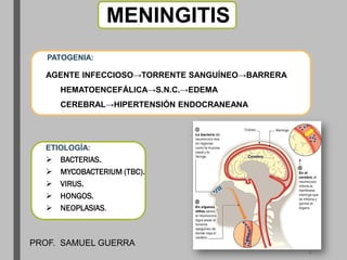 MENINGITIS
PATOGENIA:
AGENTE INFECCIOSO→TORRENTE SANGUÍNEO→BARRERA
HEMATOENCEFÁLICA→S.N.C.→EDEMA
CEREBRAL→HIPERTENSIÓN ENDOCRANEANA.
ETIOLOGÍA:
 BACTERIAS.
 MYCOBACTERIUM (TBC).
 VIRUS.
 HONGOS.
 NEOPLASIAS.
PROF. SAMUEL GUERRA
4
 