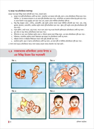 cÖwk¶Y mnvwqKv18
M) R‡b¥i c‡i cÖwZewÜZvi KviYmg~n
R‡b¥i c‡i gvbyl wewfbœ Kvi‡Y cÖwZeÜx n‡Z cv‡i, †m¸‡jv n‡jv-
1. R‡b¥i ci Acywó cÖwZewÜZvi GKwU eo KviY| Av‡qvwWb Gi Afv‡e e¨w³ eyw×, kªeY I evK& cÖwZewÜZvi ¯^xKvi n‡Z cv‡i|
wfUvwgb ÔGÕ Gi Afv‡e ivZKvbv ev Gi †_‡K `„wó cÖwZewÜZv n‡Z cv‡i| K¨vjwmqvg Gi Afv‡e e¨w³i nuvo `ye©j n‡Z cv‡i|
hv †_‡K wi‡KU ev nvo gyogywo †ivM n‡Z cv‡i Ges G¸‡jv †_‡K kvixwiK cÖwZewÜZv m„wó nq|
2. wKQy wKQy Amy¯’Zv †hgb- †cvwjI, Wvqv‡ewUm, Kzô cÖf…wZ †iv‡Mi Kvi‡Y gvbyl kvixwiK cÖwZeÜx n‡Z cv‡i| nvg, emšÍ,
Møy‡Kvgv, Uªv‡Kvgv, Wvqv‡ewUm, Wvqwiqv cÖf…wZ Kvi‡Y `„wó cÖwZewÜZv n‡Z cv‡i| †óªvK, g„Mx cÖf…wZ †_‡K eyw× cÖwZewÜZvi m„wó
n‡Z cv‡i|
3. moK `yN©Ubv, †K‡U hvIqv, cy‡o hvIqv, MvQ ev Qv` †_‡K c‡o hvIqv BZ¨vw` `yN©Ubv¸‡jv cÖwZewÜZvi GKwU eo KviY|
4. fzj Jla ev Kov JlaI cÖwZewÜZvi KviY n‡Z cv‡i|
5. KxUbvkK ev Ab¨ †Kvb welwµqv cÖf…wZ †_‡K I cwi‡ek `~l‡Yi d‡j wewfbœ AmyL- Gi d‡j cÖwZewÜZvi m„wó n‡Z cv‡i|
6. UvBd‡qW, g¨v‡jwiqv cÖf…wZi Kvi‡Y D”PgvÎvi R¦i R‡b¥i ci cÖwZewÜZvi GKwU eo KviY|
7. gw¯Í‡®‹i AvNvZ ev gw¯Í‡®‹i wUDgv‡ii Kvi‡Y e¨w³ eyw× cÖwZeÜx n‡Z cv‡i|
8. cÖvK…wZK `y‡h©vM, hy× ev mš¿vmI cÖwZewÜZvi GKwU eo KviY, Gi d‡j `„wó ev kvixwiK cÖwZewÜZvi m„wó n‡Z cv‡i|
G mKj KviY QvovI cÖwZewÜZvi AviI KviY i‡q‡Q †h¸‡jv AvRI D`&NvUb Kiv m¤¢e nqwb|
2.4 beRvZ‡Ki cÖwZewÜZv †Pbvi Dcvq I
Gi wewfbœ wP‡ýi wPÎ ms‡hvRbx
wPÎ: 2 wPÎ: 3
wPÎ: 4 wPÎ: 5
 