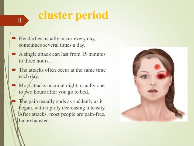 cluster headaches