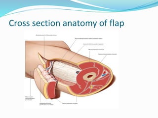 anterolateral thigh flap | PPTX