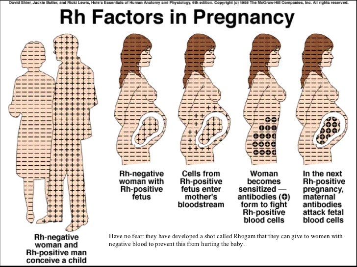 a negative blood type pregnancy complications a negative blood type pregnancy complications