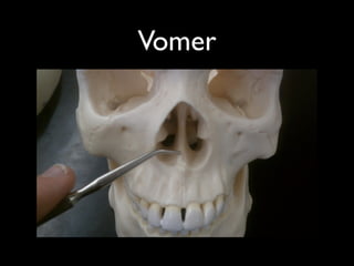 Vomer
 