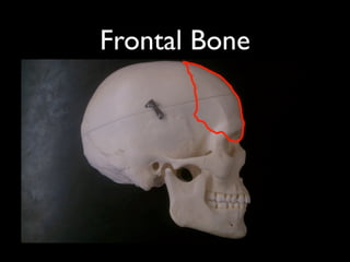 Frontal Bone
 