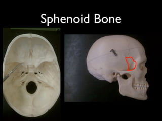 Sphenoid Bone
 