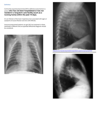 Definition

Community-acquired pneumonia (CAP) is defined as pneumonia in a
patient who has not been hospitalized or has not
resided in a long-term care facility (such as a
nursing home) within the past 14 days.

It is an infection of the lower respiratory tract associated with signs or
symptoms of acute infection and new CXR infiltrate.

Immunocompromised patients can get CAP, but treatment in these
individuals is different and an expanded differential diagnosis should
be considered.




                                                                             http://www.hawaii.edu/medicine/pediatrics/pemxray/v4c03.html
 