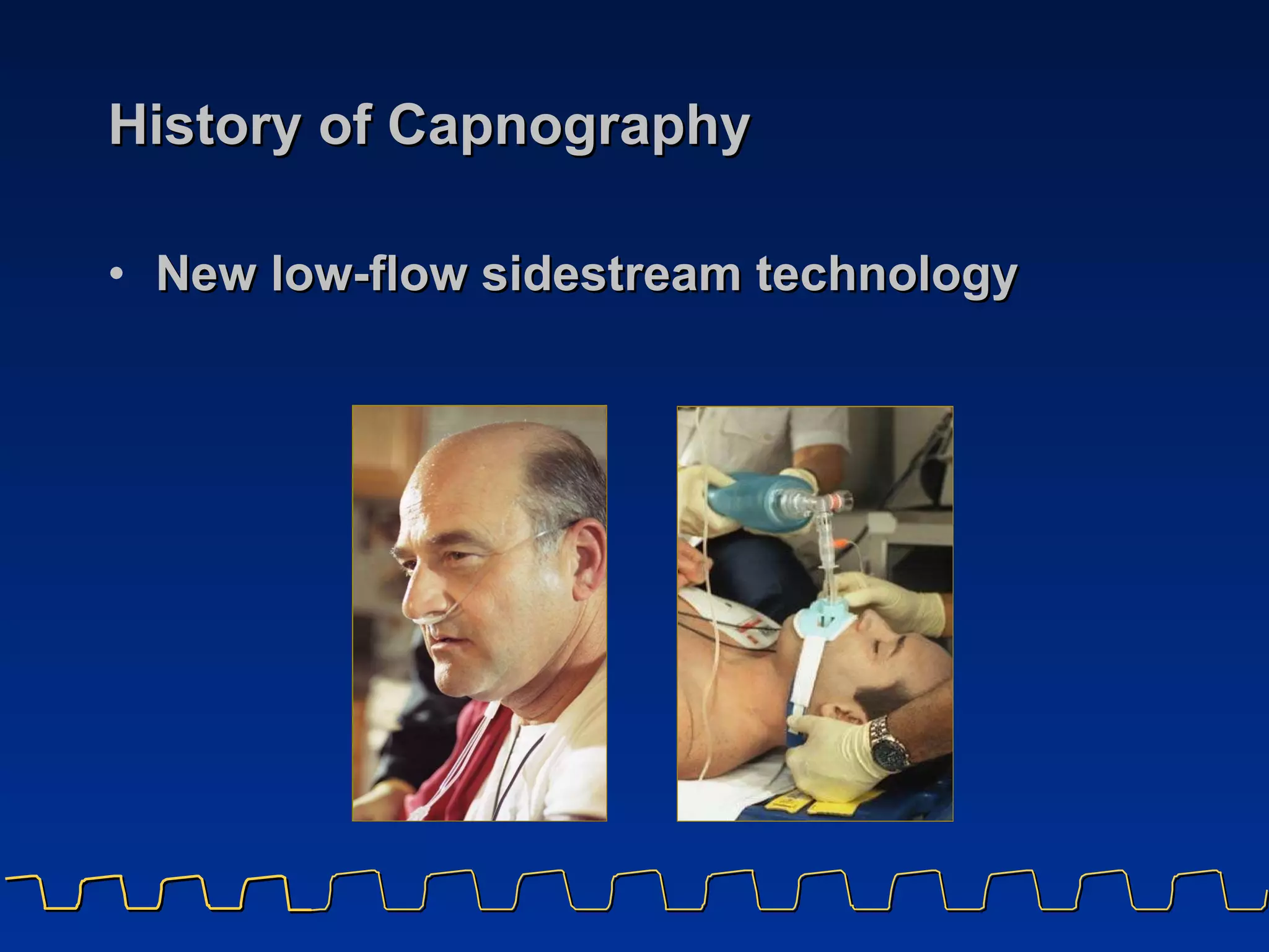 History of Capnography New low-flow sidestream technology 