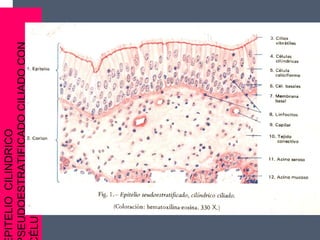 PITELIOCILINDRICO
SEUDOESTRATIFICADOCILIADOCON
ÉLULASCALICIFORMES
 