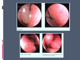 14 cavidad nasal y_senos_perinasales_2_ - 