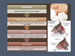 14 cavidad nasal y_senos_perinasales_2_ - 