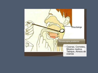 14 cavidad nasal y_senos_perinasales_2_ - 