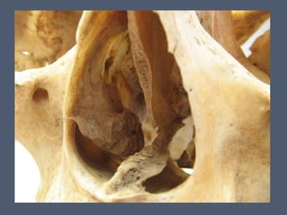 14 cavidad nasal y_senos_perinasales_2_ - 