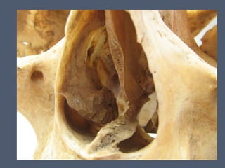 14 cavidad nasal y_senos_perinasales_2_ - 