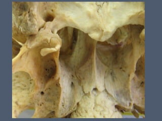 14 cavidad nasal y_senos_perinasales_2_ - 